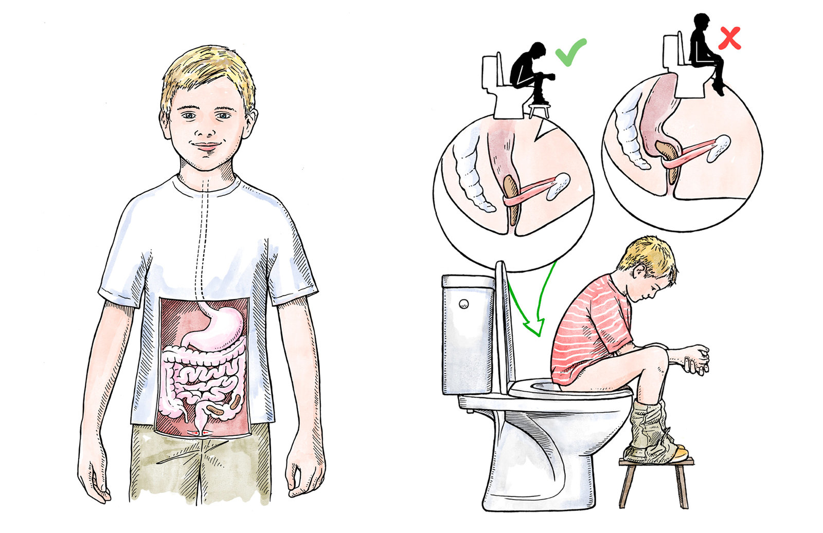 oculus-illustration-urologie-kinder-zeichnung-magendarmtrakt-stuhlgang