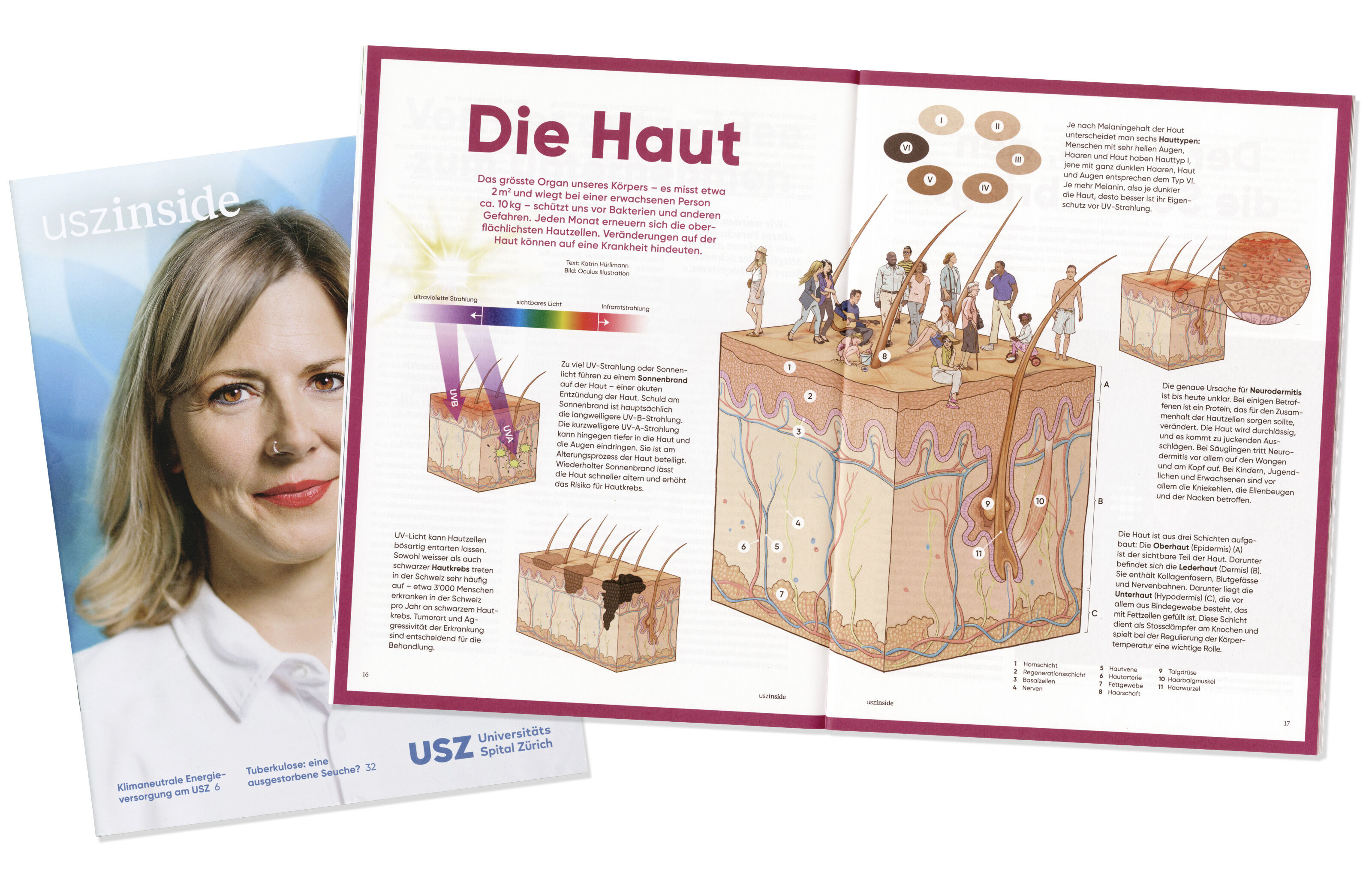 oculus-illustration-medizin-universitaetsspital-magazin-haut-infografik-magazin